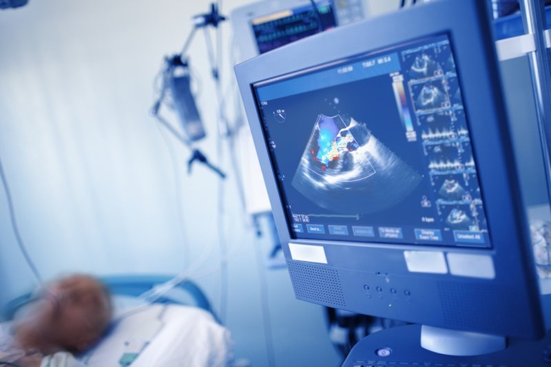 ESC 2022: UltraSight claims European approval for AI-guided heart ultrasound