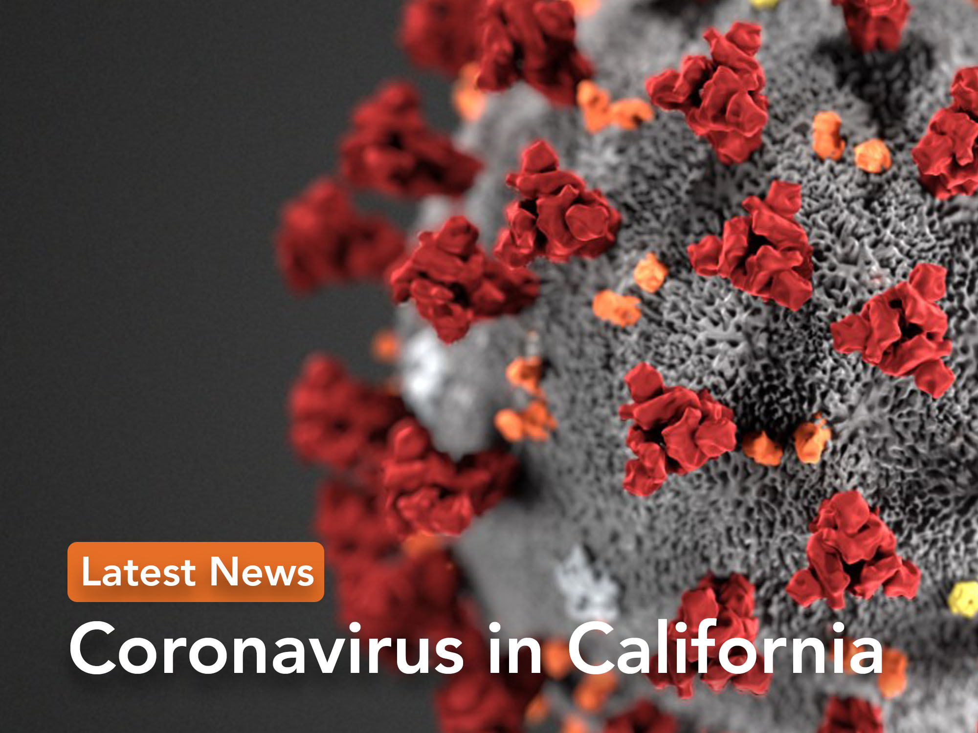 California coronavirus updates: COVID-19 is a contributor to lowered life expectancy in US